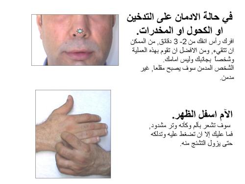 العلاج بالضغط الإصبعي Slide1751